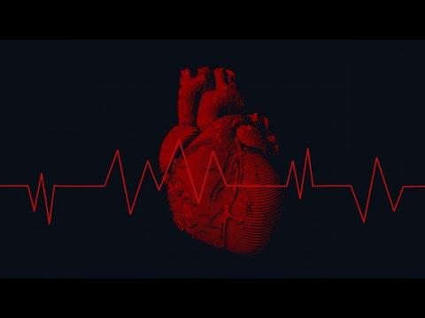 Goldzik - Arytmia (Original Mix)