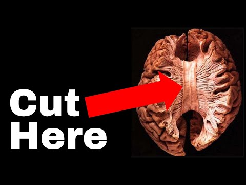 The Unsettling Truth about Human Consciousness | The Split Brain experiment that broke neuroscience