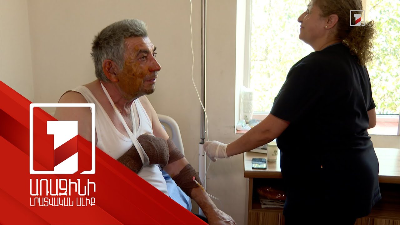 Պայթյունից տուժած քաղաքացիների ինքնազգացողությունը բավարար է