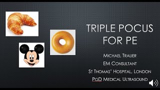 Triple PoCUS for PE