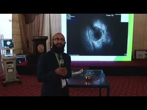 Basics of IVUS, FFR, iFR, qFR - Abidullah Jan