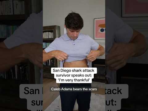 Shark Bite Scars