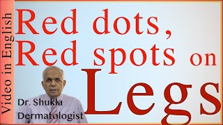 Red dots/spots on legs