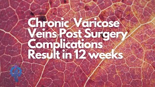 How We Come Back from Chronic Varicose Veins Post Surgery Complications | Hyperarch Fascia Training