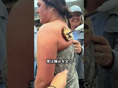 痛みが一切ない「凍結焼き印」の秘密