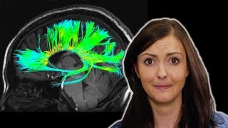4 Odd Things We've Seen in Your Brain