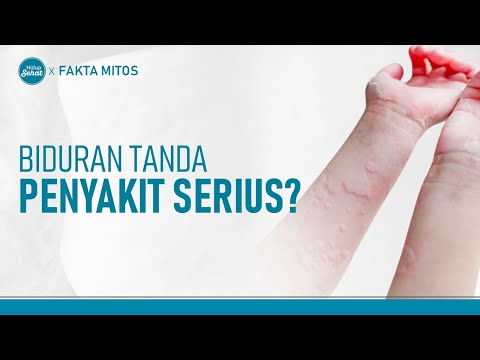 Waspada! Biduran Bisa Jadi Tanda Penyakit Serius | Hidup Sehat tvOne