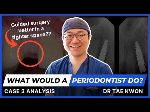 What Would A Periodontist Do? - Clinical Case 3