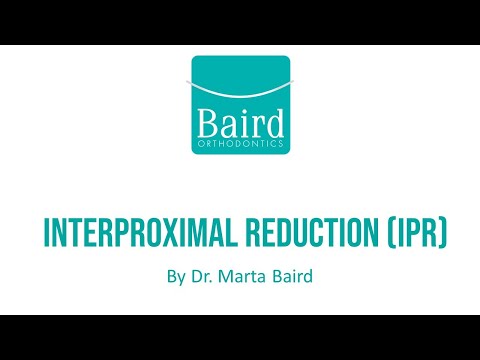 Interproximal Reduction IPR at Baird Orthodontics