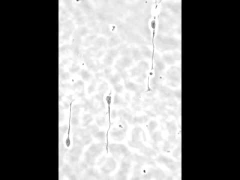 Axon growth cone of primary rat hippocampal neurons on Motility CYTOOchips