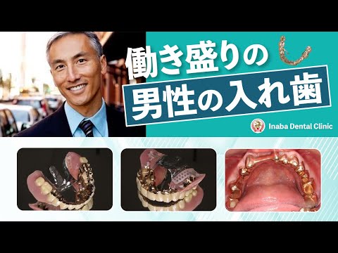 働き盛りの男性の入れ歯について