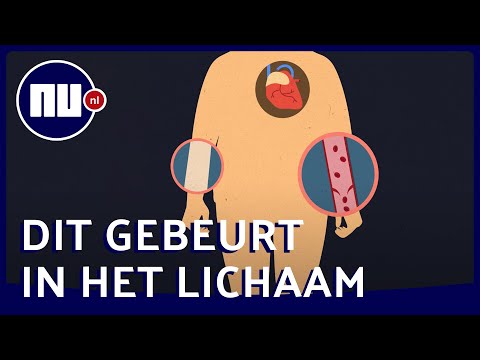 Hoe je kunt overlijden door extreme hitte | NU.nl