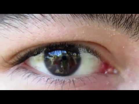 Pesty Sida x TogBeats - Levadura (Video Oficial)