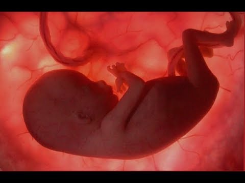 Argument for abortion: It may be necessary to save the mother's life Video