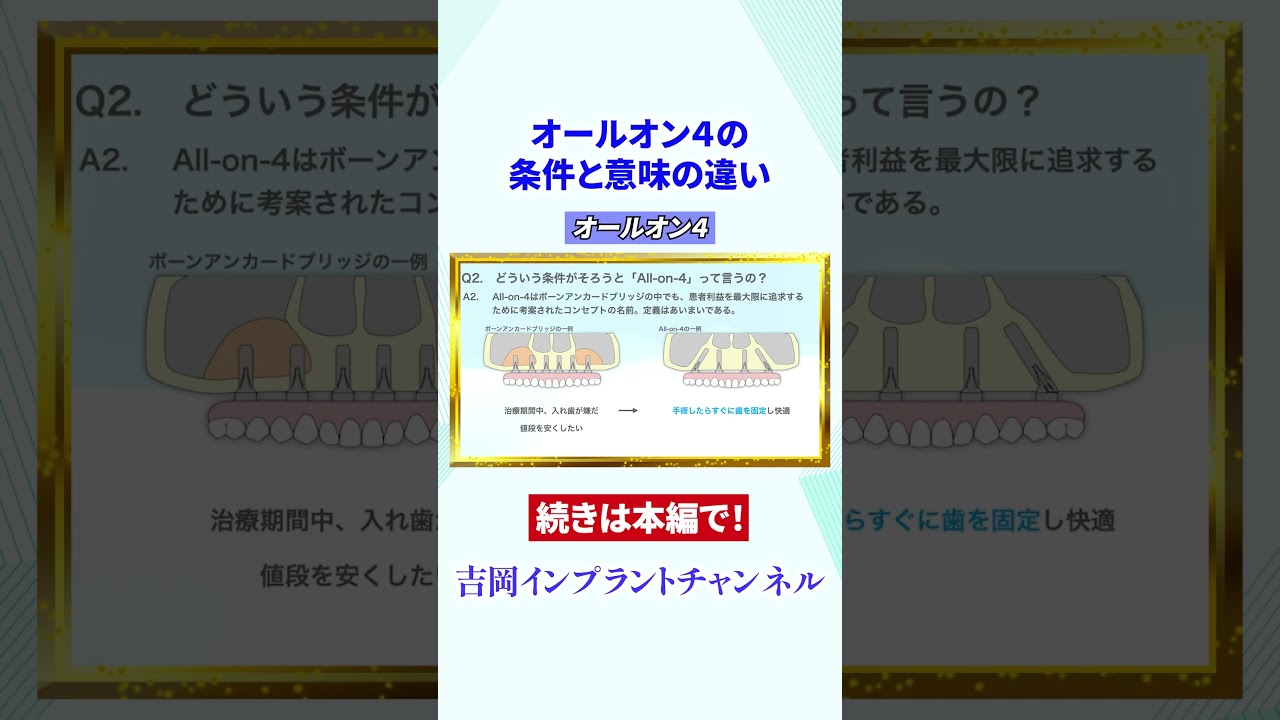 オールオン４の条件と意味の違い#shorts#インプラント#オールオン４
