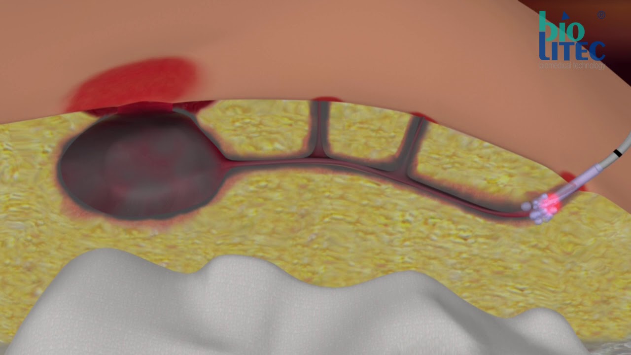 Alberto Carrillo Acosta-3