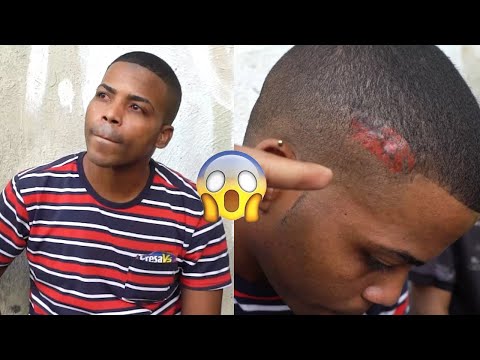 LE DAN DISPAROS EL LA CABEZA y Queda vivo | Especial Semana Santa