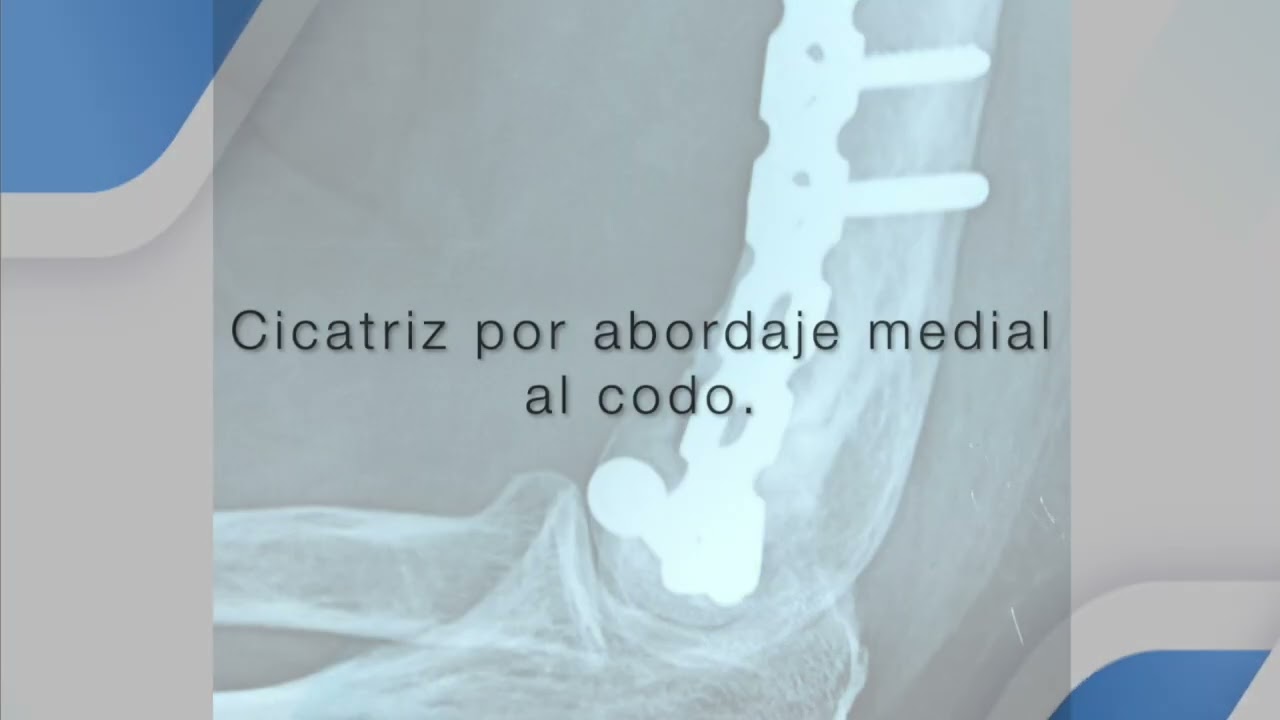 Gerardo Bautista Díaz-18