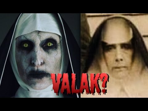 Żagle wypadanie włosów Bad lekarstwem na wypadanie włosów