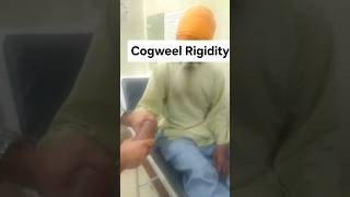 Cogwheel Rigidity - Parkinson's Disease