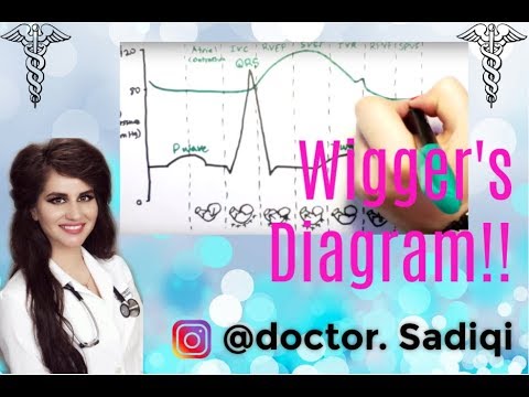 Wigger's Diagram EXPLAINED WITHIN 3 MINUTES!!!