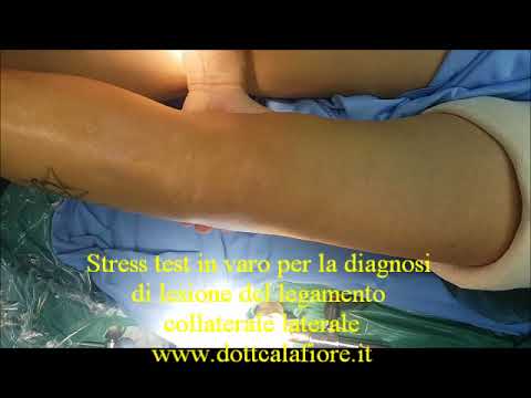 Sale marino nel trattamento dellosteoartrosi Foglia dacero per il trattamento delle articolazioni