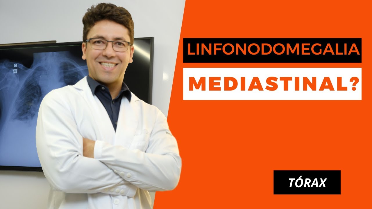 APRENDA A INTERPRETAR LINFONODOMEGALIAS MEDIASTINAIS