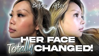 Her Ultimate Glow-Up 😱✨ | Em's plastic surgery journey at Braun! (Part 1)
