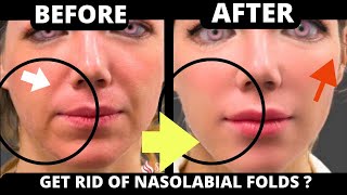 🛑 HOW TO GET RID OF NASOLABIAL FOLDS WITH FACE YOGA ? JOWLS, SAGGY SKIN, FOREHEAD, MOUTH LINES, EYES
