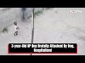 Dog Attack Baby | 3-year-Old UP Boy Brutally Attacked By Dog, Hospitalised - Video