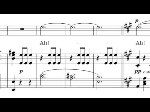 Accompaniment (D major) Il bacio -with Melody