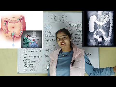 bawasir me konsa test krbana chahiye💯 // bawasir me konsi janch krbani chahiye👌||