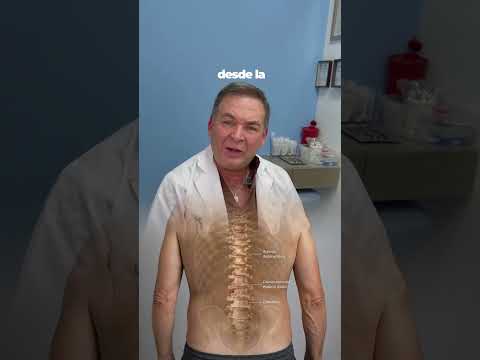 ¿La escoliosis puede aparecer en adultos? Causas y tratamiento | Barranquilla