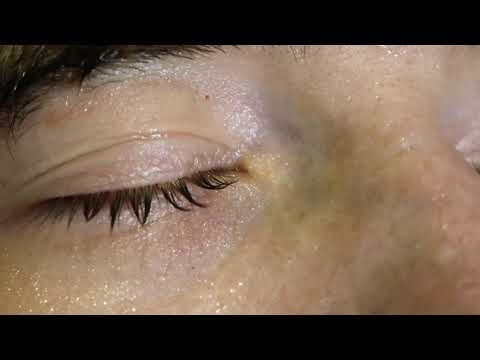 MIARA PZS - SERCE (VIDEO)