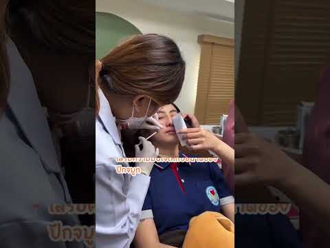 รีวิวหัตถการโปรแกรมโบท็อกปีกจมูก