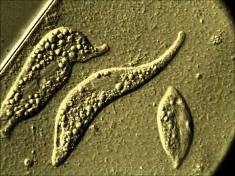 Mit kell kezdeni a pinworm fertőzéssel