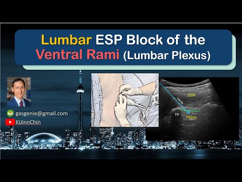 Lumbar ESP Block - for Hip & Lower Limb Analgesia