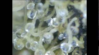 Marijuana 400x Zoomed In