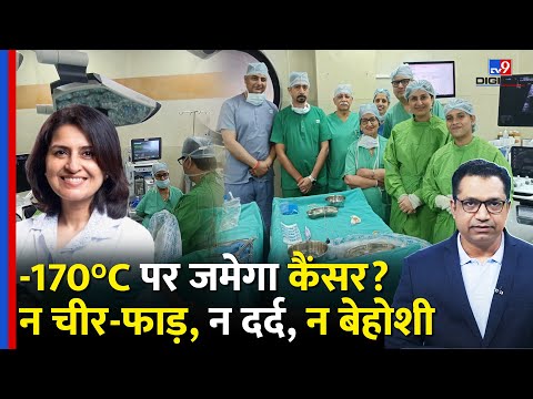 TV9: Cancer Treatment Without Surgery (Cryoablation)