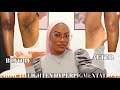 THE BEST WAYS TO LIGHTEN DARK ARMPITS DARK INNER THIGHS BIKINI AREA ELBOWS KNEES