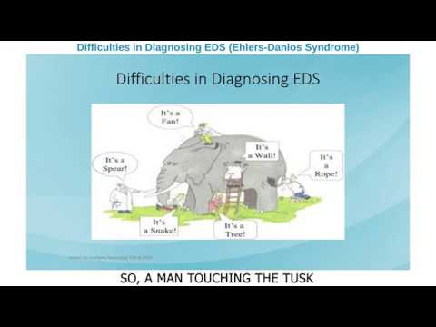 Difficulties in Diagnosing EDS