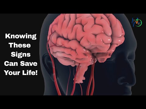 🧠 Recognizing a Stroke: Life-Saving Signs You Need to Know | The Vitality Report - Symptom Series