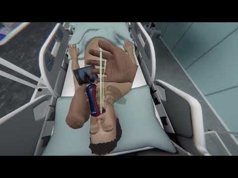 Náhled pro video reference