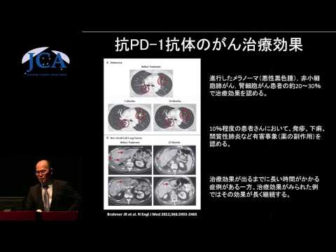 栄養学科 講演3「がん免疫療法の最前線」 玉田　耕治（山口大学大学院医学系研究科　免疫学分野　教授）