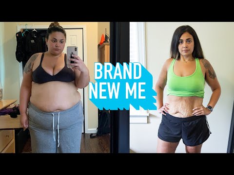 I Prefer Having Saggy Skin To Weighing 298LBS | BRAND NEW ME
