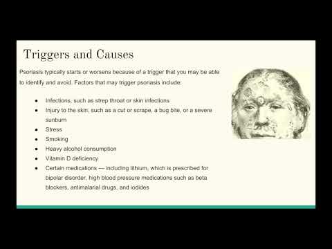 Psoriasis by Iryna Ivanova