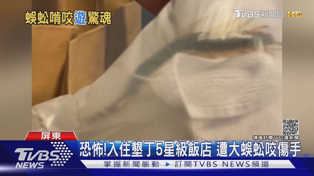 驚！入住墾丁5星級飯店　遭15公分大蜈蚣咬傷手指