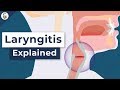 Why Do You Lose Your Voice Laryngitis Explained