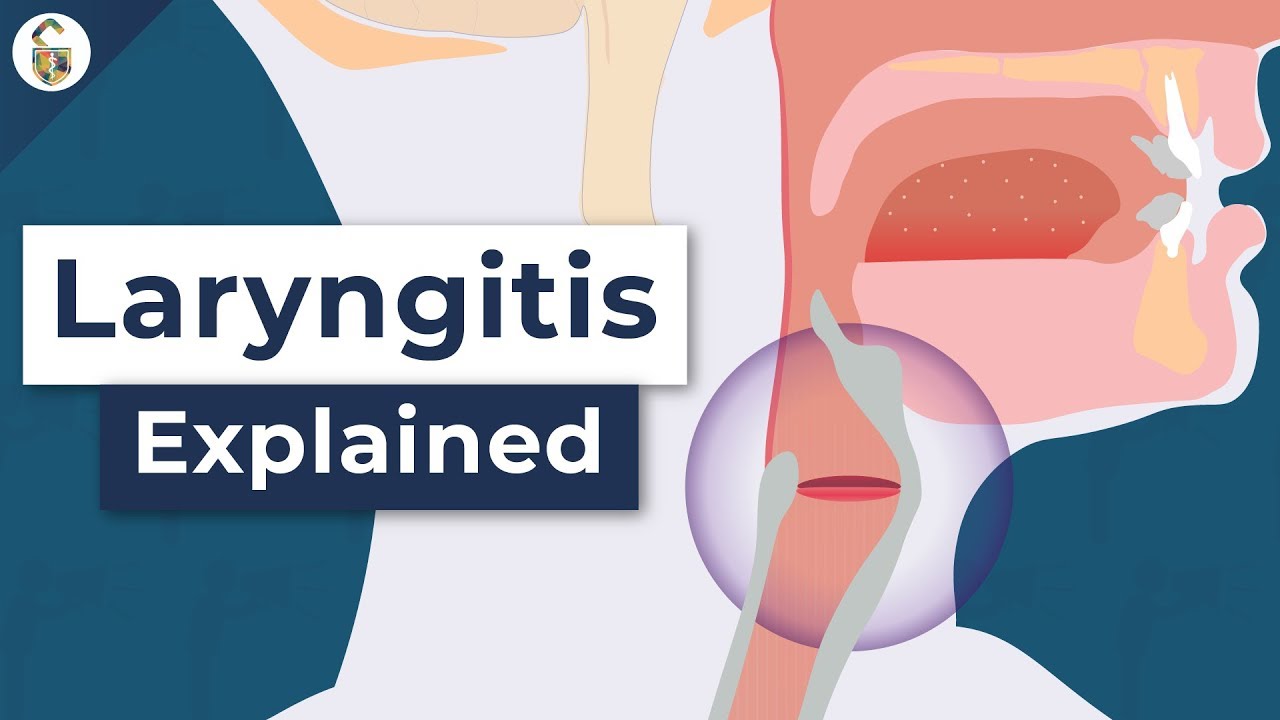 Why Do You Lose Your Voice? - Laryngitis Explained