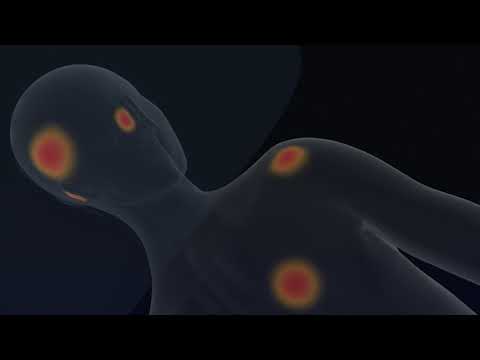 Dabir Surfaces -  Pressure Injury Prevention Dynamic Air Mattress - How it Works